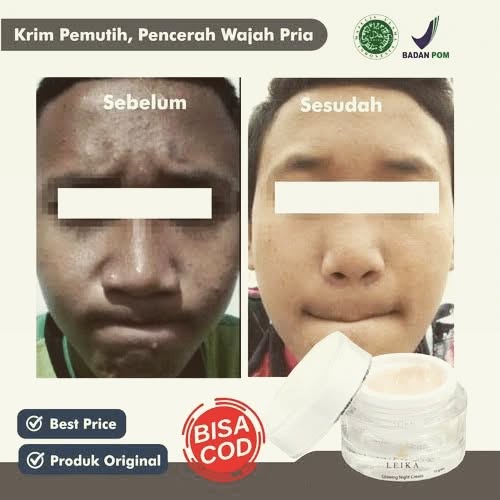 Waspada Kosmetik Ilegal Ancam Nyawa: Picu Kanker, Kerusakan Ginjal Permanen, hingga Cacat Janin
